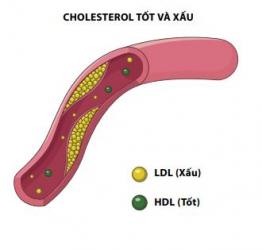 Understanding Good Cholesterol and Bad Cholesterol ?